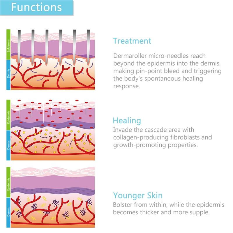 0.5mm Dermaroller - Hair Growth For Scalp & Beard