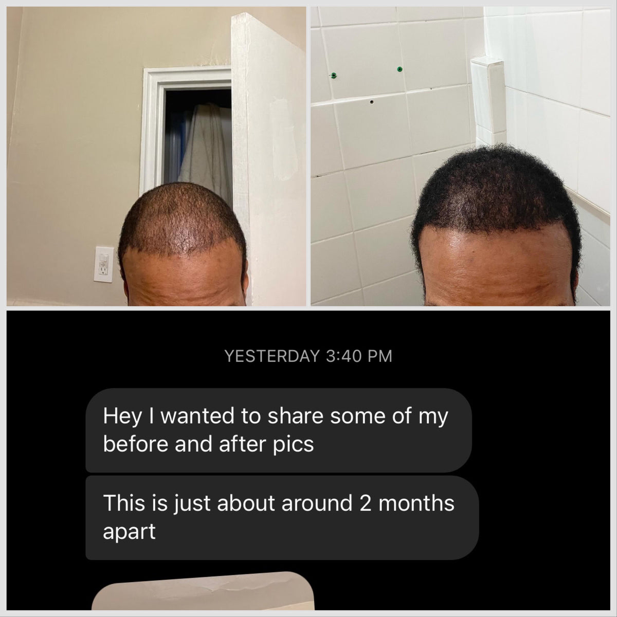 Shampoo