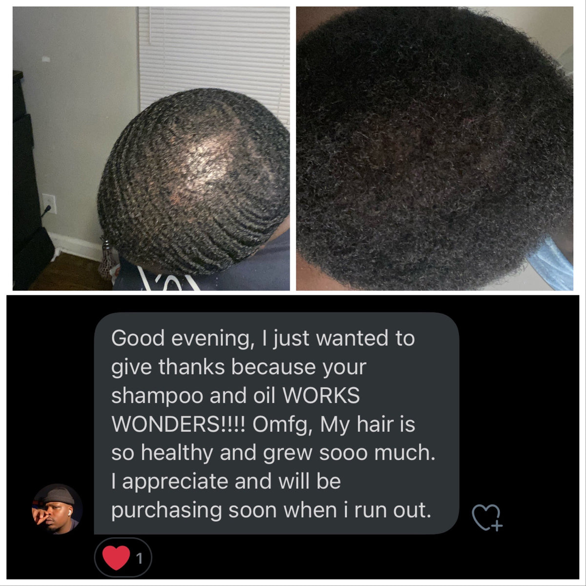Shampoo